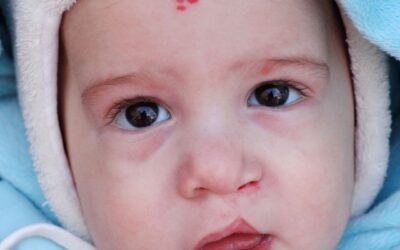 Szoptatás ajak- és szájpadhasadékkal – Fabienne és Mauro története Németországból